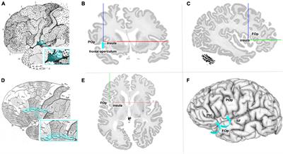 Cytoarchitectonic mapping of the human frontal operculum—New correlates for a variety of brain functions
